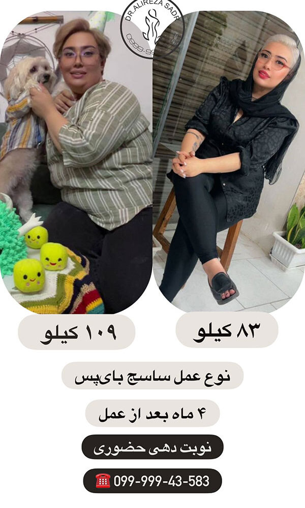 افرادی که عمل چاقی کرده اند قبل و بعد